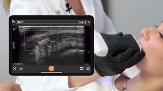 Vascular mapping of the lips