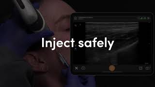 Clarius for aesthetic