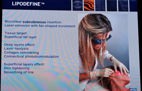 רויטל בראלי