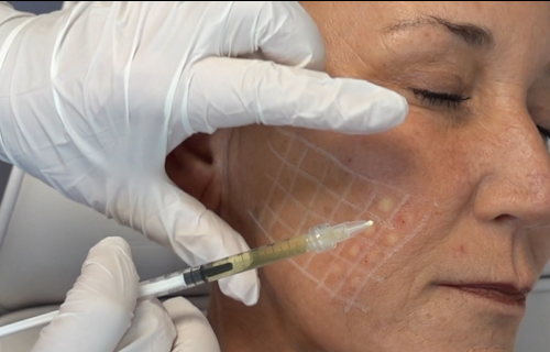 צילום מסך 2024-06-25 095627