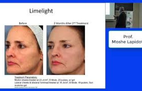 פרופ משה לפידות